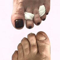 Toenail Reconstruction Kit - Pedisafe Starter Case (Lamp included)