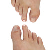 Toenail Reconstruction Kit - Pedisafe Starter Case